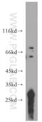 T Cell Immune Regulator 1, ATPase H+ Transporting V0 Subunit A3 antibody, 12649-1-AP, Proteintech Group, Western Blot image 