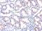 Tumor Susceptibility 101 antibody, MA1-23296, Invitrogen Antibodies, Immunohistochemistry paraffin image 