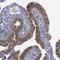 CRK Like Proto-Oncogene, Adaptor Protein antibody, NBP1-86181, Novus Biologicals, Immunohistochemistry paraffin image 