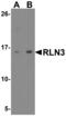 Relaxin 3 antibody, MBS153541, MyBioSource, Western Blot image 