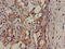 Src-Related Kinase Lacking C-Terminal Regulatory Tyrosine And N-Terminal Myristylation Sites antibody, LS-C673996, Lifespan Biosciences, Immunohistochemistry frozen image 