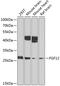 Fibroblast Growth Factor 12 antibody, 18-759, ProSci, Western Blot image 