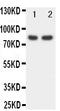Forkhead Box P1 antibody, PA1593, Boster Biological Technology, Western Blot image 