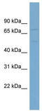 High affinity cationic amino acid transporter 1 antibody, TA334047, Origene, Western Blot image 