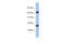 Uncharacterized protein FLJ37543 antibody, 27-066, ProSci, Enzyme Linked Immunosorbent Assay image 