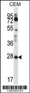 Retinoic Acid Receptor Responder 1 antibody, 56-875, ProSci, Western Blot image 
