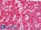 Cytochrome C1 antibody, LS-C211039, Lifespan Biosciences, Immunohistochemistry paraffin image 