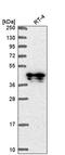 Spindlin Interactor And Repressor Of Chromatin Binding antibody, PA5-65609, Invitrogen Antibodies, Western Blot image 