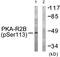Protein Kinase CAMP-Dependent Type II Regulatory Subunit Beta antibody, AP55723PU-N, Origene, Western Blot image 