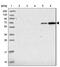 Zinc Finger SWIM-Type Containing 1 antibody, PA5-61305, Invitrogen Antibodies, Western Blot image 