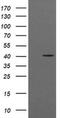 Acetyl-CoA Acyltransferase 2 antibody, MA5-26253, Invitrogen Antibodies, Western Blot image 
