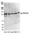 WASH Complex Subunit 4 antibody, A304-919A, Bethyl Labs, Western Blot image 