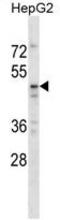 TAP Binding Protein Like antibody, AP54150PU-N, Origene, Western Blot image 