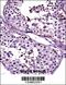 Autoimmunogenic cancer/testis antigen NY-ESO-2 antibody, 57-255, ProSci, Immunohistochemistry paraffin image 
