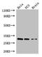 Homeobox protein Hox-B13 antibody, orb47151, Biorbyt, Western Blot image 