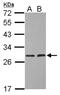 Hydroxysteroid 17-Beta Dehydrogenase 10 antibody, NBP2-16360, Novus Biologicals, Western Blot image 