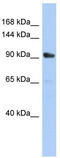 Kinesin-like protein KIF23 antibody, TA334691, Origene, Western Blot image 