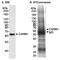 Histone-arginine methyltransferase CARM1 antibody, A300-420A, Bethyl Labs, Immunoprecipitation image 