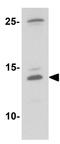 C-C Motif Chemokine Ligand 4 antibody, GTX17201, GeneTex, Western Blot image 