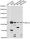 Unc-5 Netrin Receptor C antibody, LS-C749789, Lifespan Biosciences, Western Blot image 