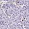 F-Box Protein 34 antibody, HPA052592, Atlas Antibodies, Immunohistochemistry paraffin image 