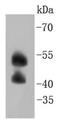 Mitogen-Activated Protein Kinase 9 antibody, NBP2-67553, Novus Biologicals, Western Blot image 