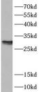 Acidic Nuclear Phosphoprotein 32 Family Member B antibody, FNab00446, FineTest, Western Blot image 