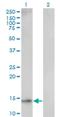 Ubiquitin Conjugating Enzyme E2 D1 antibody, H00007321-M01, Novus Biologicals, Western Blot image 