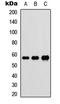 DnaJ Heat Shock Protein Family (Hsp40) Member C3 antibody, LS-C354338, Lifespan Biosciences, Western Blot image 