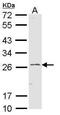 Glutathione S-Transferase Alpha 1 antibody, PA5-29811, Invitrogen Antibodies, Western Blot image 