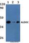 Aldolase, Fructose-Bisphosphate C antibody, LS-C412111, Lifespan Biosciences, Western Blot image 