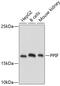 Peptidylprolyl Isomerase F antibody, 18-995, ProSci, Western Blot image 