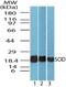 Superoxide Dismutase 1 antibody, NBP2-24915, Novus Biologicals, Western Blot image 