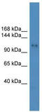Ubiquitin carboxyl-terminal hydrolase 8 antibody, TA342559, Origene, Western Blot image 