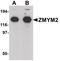 Zinc Finger MYM-Type Containing 2 antibody, PA5-21090, Invitrogen Antibodies, Western Blot image 