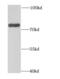 Growth Arrest Specific 6 antibody, FNab03352, FineTest, Western Blot image 
