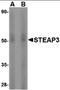 STEAP3 Metalloreductase antibody, orb87360, Biorbyt, Western Blot image 