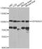 Heat shock protein HSP 90-alpha antibody, LS-C747550, Lifespan Biosciences, Western Blot image 