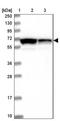 Leucine Rich Repeat Containing 63 antibody, NBP1-90670, Novus Biologicals, Western Blot image 