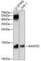 Regulated On Activation In Normal T-Cell Expressed And Secreted  antibody, 19-765, ProSci, Western Blot image 