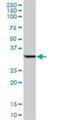 Coiled-Coil Domain Containing 148 antibody, H00130940-B01P, Novus Biologicals, Western Blot image 