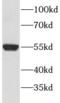 Diacylglycerol O-acyltransferase 1 antibody, FNab02349, FineTest, Western Blot image 