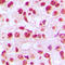REL Proto-Oncogene, NF-KB Subunit antibody, LS-C352767, Lifespan Biosciences, Immunohistochemistry paraffin image 