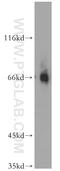 Excitatory amino acid transporter 3 antibody, 12686-1-AP, Proteintech Group, Western Blot image 