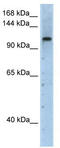 Pre-MRNA Processing Factor 6 antibody, TA343789, Origene, Western Blot image 