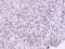 Zinc Fingers And Homeoboxes 2 antibody, PA5-22217, Invitrogen Antibodies, Immunohistochemistry frozen image 