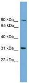 NEDD4 Binding Protein 2 Like 2 antibody, TA333591, Origene, Western Blot image 
