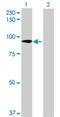 Zinc Finger Protein 573 antibody, H00126231-B01P, Novus Biologicals, Western Blot image 