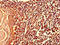 Myosin-X antibody, LS-C678729, Lifespan Biosciences, Immunohistochemistry paraffin image 