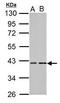 PKACA antibody, TA308159, Origene, Western Blot image 